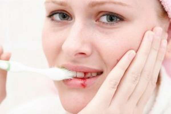 Кровотечение изо рта при переломе зуба